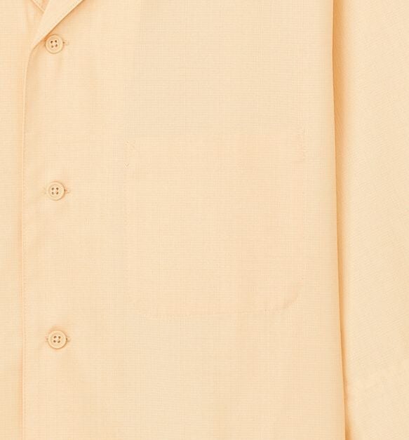 左胸の外部分の写真